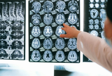 وظائف الدماغ