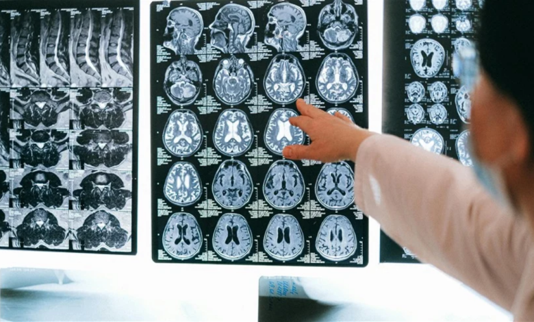 وظائف الدماغ